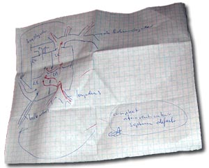 Schematic drawing (14kb)